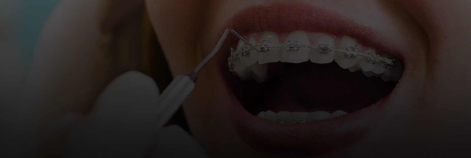 Tri-City Orthodontics - Braces